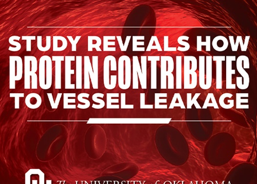 Study Illuminates Contributing Factors to Blood Vessel Leakage