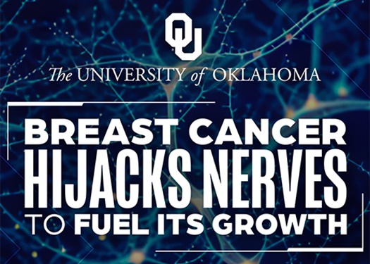 Researchers Discover How Tumors Enlist Nerves to Keep Growing