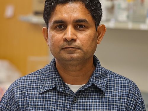 $2 Million NCI Grant Funds Research on How Pancreatic Cancer Uses Cholesterol to Survive