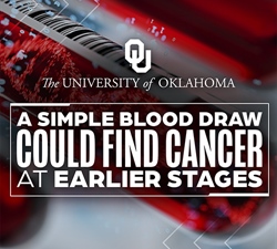 OU Study Examines Whether Blood Tests Can Detect Cancer