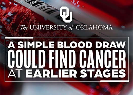 OU Study Examines Whether Blood Tests Can Detect Cancer